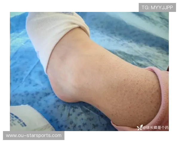 骨折了还拄拐杖去看球,谁劝都不听,骨折拄拐算负重吗 骨折了还拄拐杖去看球,谁劝都不听,骨折拄拐算负重吗